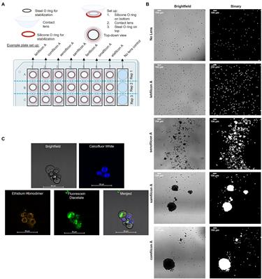 Acanthamoeba spp. aggregate and encyst on contact lens material increasing resistance to disinfection